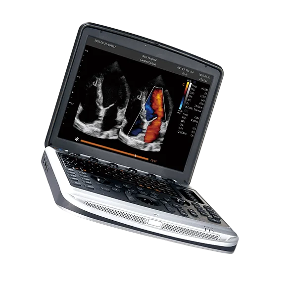 Chison SonoBook 8