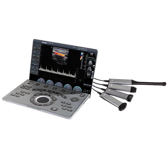 Chison SonoAir 30 VET